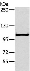 NPRB / NPR2 Antibody - Western blot analysis of Mouse liver tissue, using NPR2 Polyclonal Antibody at dilution of 1:300.