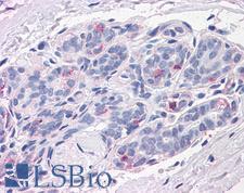 NPTN / SDR1 Antibody - Anti-NPTN antibody IHC of human breast. Immunohistochemistry of formalin-fixed, paraffin-embedded tissue after heat-induced antigen retrieval.