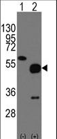 NPTX2 Antibody - Western blot of NARP(Nptx2) (arrow) using rabbit polyclonal NARP(Nptx2) Antibody. 293 cell lysates (2 ug/lane) either nontransfected (Lane 1) or transiently transfected with the NARP(Nptx2) gene (Lane 2) (Origene Technologies).