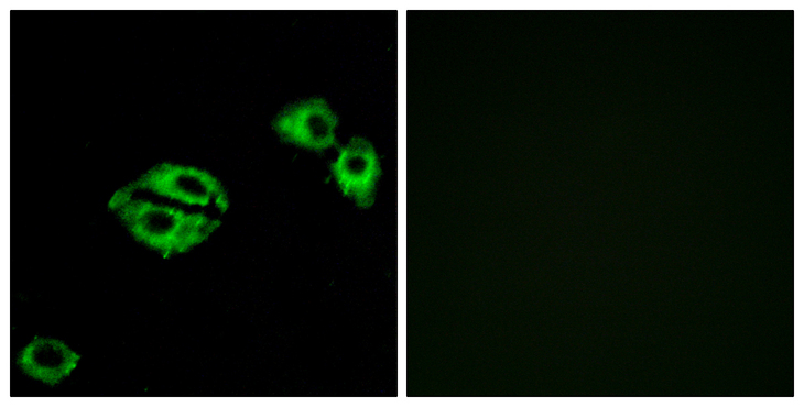 NPY5R Antibody - Immunofluorescence analysis of A549 cells, using NPY5R Antibody. The picture on the right is blocked with the synthesized peptide.