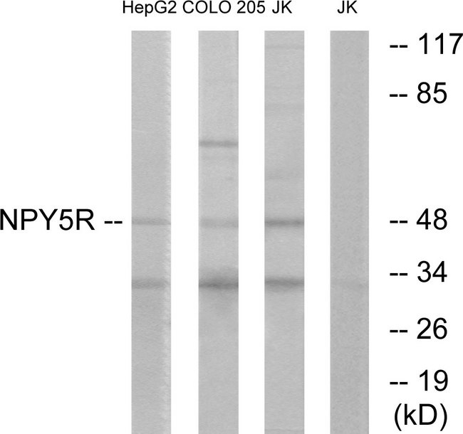 NPY5R Antibody - Western blot analysis of lysates from COLO, Jurkat, and HepG2 cells, using NPY5R Antibody. The lane on the right is blocked with the synthesized peptide.
