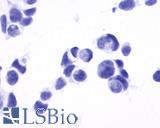 NPY5R Antibody - Anti-NPY5R antibody immunocytochemistry (ICC) staining of untransfected HEK293 human embryonic kidney cells.
