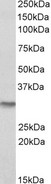 NQO1 Antibody - NQO1 antibody (0.3µg/ml) staining of Human Kidney lysate (35µg protein in RIPA buffer). Detected by chemiluminescence.