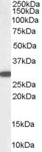 NQO1 Antibody - NQO1 antibody staining (0.03ug/ml) of Human Kidney lysate (RIPA buffer, 35ug total protein per lane). Primary incubated for 1 hour. Detected by western blot using chemiluminescence.