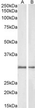 NQO1 Antibody - NQO1 antibody (1ug/ml) staining of Rat (A) and Pig (B) Kidney lysate (35ug protein in RIPA buffer). Primary incubation was 1 hour. Detected by chemiluminescence.