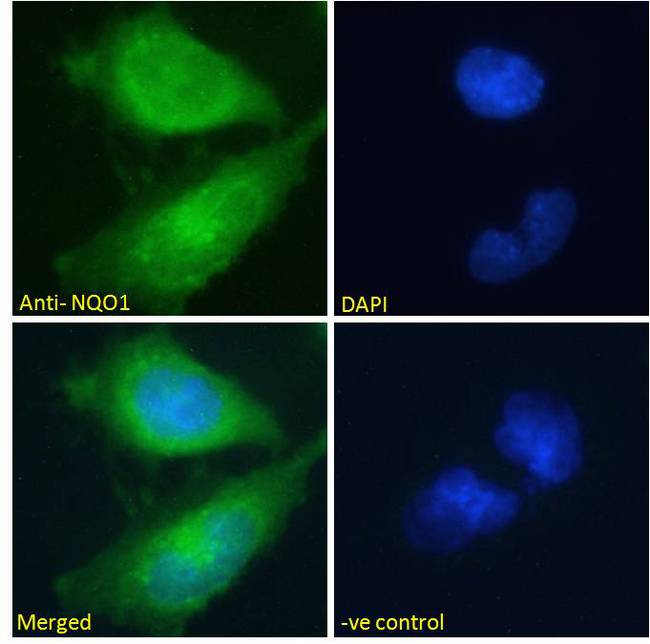 NQO1 Antibody - NQO1 Antibody Immunofluorescence analysis of paraformaldehyde fixed U251 cells, permeabilized with 0.15% Triton. Primary incubation 1hr (10ug/ml) followed by Alexa Fluor 488 secondary antibody (2ug/ml), showing cytoplasmic staining. The nuclear stain is DAPI (blue). Negative control: Unimmunized goat IgG (10ug/ml) followed by Alexa Fluor 488 secondary antibody (2ug/ml).