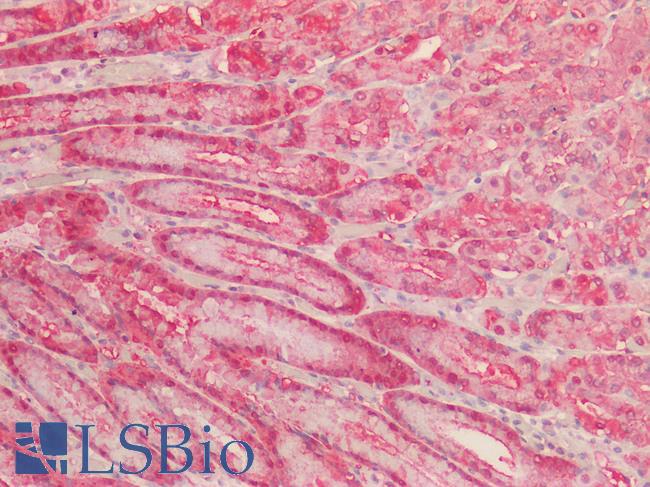 NQO1 Antibody - Human Stomach: Formalin-Fixed, Paraffin-Embedded (FFPE) HIER using 10 mM sodium citrate buffer pH 6.0