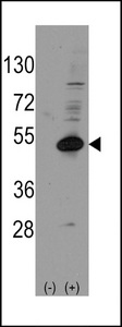 NR0B1 / DAX1 Antibody - Western blot of NROB1 (arrow) using rabbit polyclonal NROB1 Antibody (Human C-term). 293 cell lysates (2 ug/lane) either nontransfected (Lane 1) or transiently transfected with the NROB1 gene (Lane 2) (Origene Technologies).
