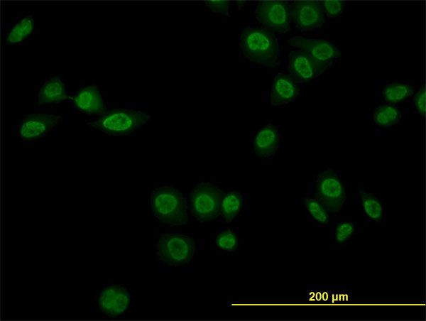 NR1D1 Antibody - Immunofluorescence of monoclonal antibody to NR1D1 on HeLa cells (antibody concentration 10 ug/ml).