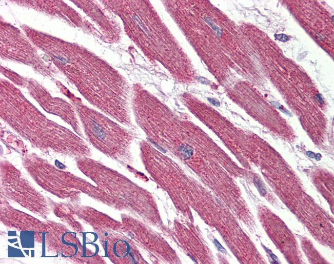 NR1D2 Antibody - Anti-NR1D2 antibody IHC of human heart. Immunohistochemistry of formalin-fixed, paraffin-embedded tissue after heat-induced antigen retrieval.