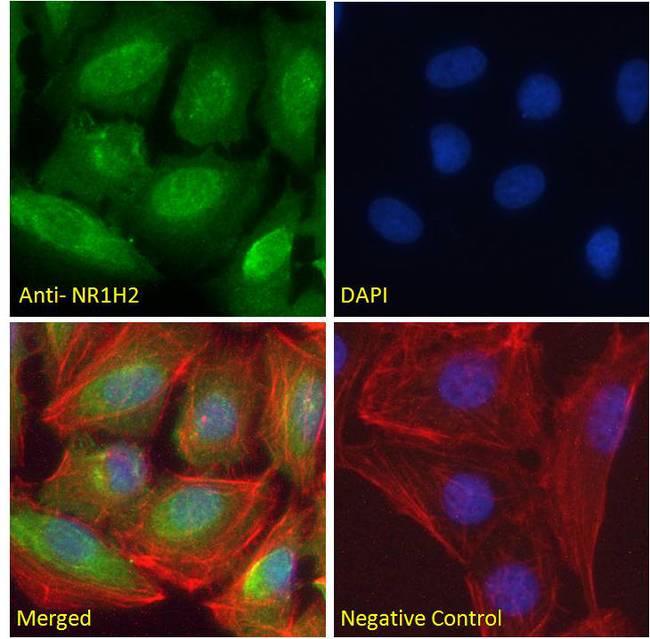 NR1H2 / LXR Beta Antibody - NR1H2 / LXR Beta antibody immunofluorescence analysis of paraformaldehyde fixed U2OS cells, permeabilized with 0.15% Triton. Primary incubation 1hr (10ug/ml) followed by Alexa Fluor 488 secondary antibody (2ug/ml), showing nuclear staining. Actin filaments were stained with phalloidin (red) and The nuclear stain is DAPI (blue). Negative control: Unimmunized goat IgG (10ug/ml) followed by Alexa Fluor 488 secondary antibody (2ug/ml).