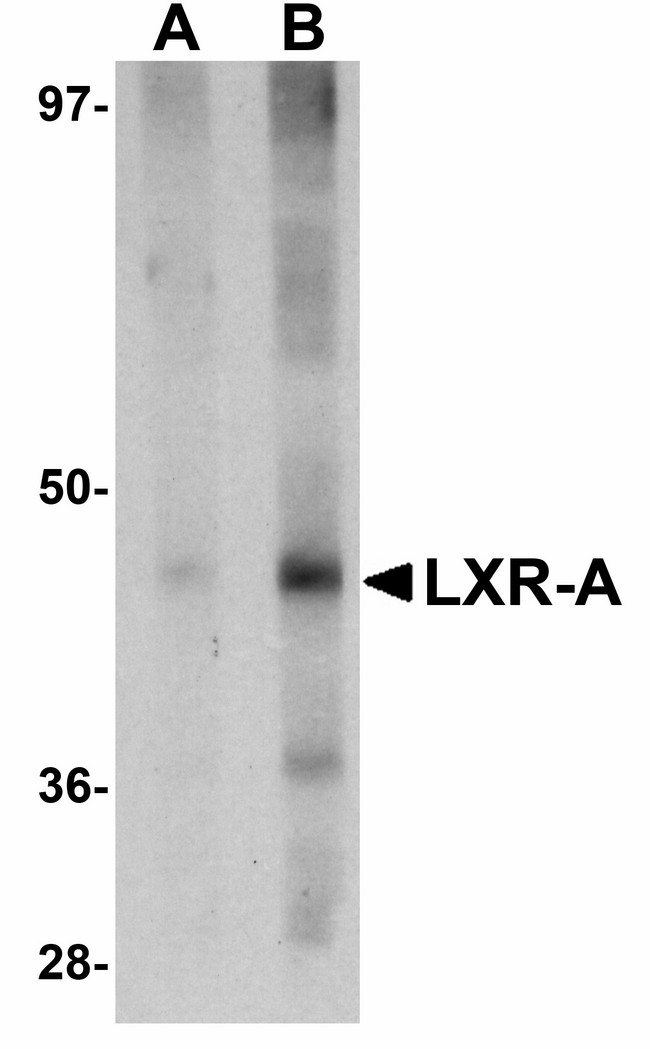 NR1H3 / LXR Alpha Antibody - Western blot of LXR-A in rat liver tissue lysate with LXR-A antibody at (A) 1 and (B) 2 ug/ml.