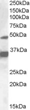 NR1I2 / PXR Antibody - NR1I2 / PXR antibody (1µg/ml) staining of HepG2 lysate (35µg protein in RIPA buffer). Detected by chemiluminescence.