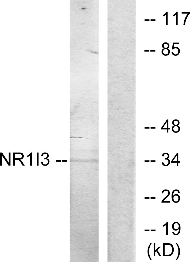 NR1I3 / CAR Antibody - Western blot analysis of lysates from Jurkat cells, treated with serum 20% 15', using NR1I3 Antibody. The lane on the right is blocked with the synthesized peptide.