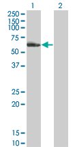 NR2C2 / TAK1 Antibody - Western blot of NR2C2 expression in transfected 293T cell line by NR2C2 monoclonal antibody clone 2A5.