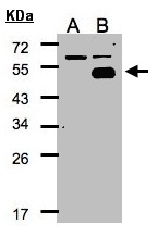 NR2F1 / Coup-TF Antibody - Western blot of NR2F1 expression in transfected 293T cell line by NR2F1 polyclonal antibody. A: Non-transfected lysate., B: NR2F1 transfected lysate. 12% SDS PAGE. NR2F1 / Coup-TF antibody diluted at 1:500