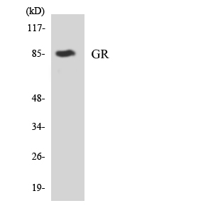 NR3C1/Glucocorticoid Receptor Antibody - Western blot analysis of the lysates from Jurkat cells using GR antibody.