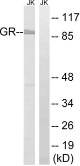 NR3C1/Glucocorticoid Receptor Antibody - Western blot analysis of lysates from Jurkat cells, treated with PMA 125ng/ml 30', using GR Antibody. The lane on the right is blocked with the synthesized peptide.