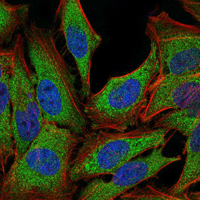 NR3C1/Glucocorticoid Receptor Antibody - Immunofluorescence of PC-2 cells using NR3C1 mouse monoclonal antibody (green). Blue: DRAQ5 fluorescent DNA dye. Red: Actin filaments have been labeled with Alexa Fluor-555 phalloidin.