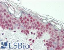 NR3C1/Glucocorticoid Receptor Antibody - Human Skin: Formalin-Fixed, Paraffin-Embedded (FFPE)