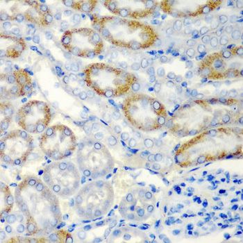 NR4A1 / NUR77 Antibody - Immunohistochemistry of paraffin-embedded mouse kidney tissue, at a dilution of 1:200.