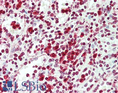 NR4A1 / NUR77 Antibody - Human Spleen: Formalin-Fixed, Paraffin-Embedded (FFPE), at a dilution of 1:100. 
