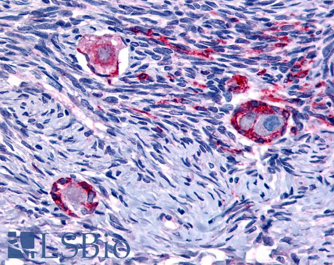 NR4A1 / NUR77 Antibody - Anti-NUR77 antibody IHC of human ovary. Immunohistochemistry of formalin-fixed, paraffin-embedded tissue after heat-induced antigen retrieval.