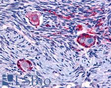 NR4A1 / NUR77 Antibody - Anti-NUR77 antibody IHC of human ovary. Immunohistochemistry of formalin-fixed, paraffin-embedded tissue after heat-induced antigen retrieval.