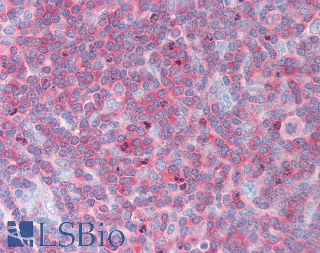 NRBP1 / NRBP Antibody - Anti-NRBP1 / NRBP antibody IHC staining of human tonsil. Immunohistochemistry of formalin-fixed, paraffin-embedded tissue after heat-induced antigen retrieval.