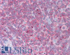 NRBP1 / NRBP Antibody - Anti-NRBP1 / NRBP antibody IHC staining of human tonsil. Immunohistochemistry of formalin-fixed, paraffin-embedded tissue after heat-induced antigen retrieval.