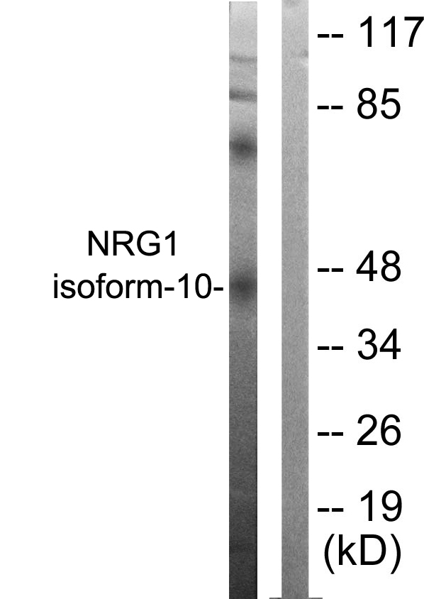 NRG1 / Heregulin / Neuregulin Antibody - Western blot analysis of lysates from SKOV3 cells, using NRG1 isoform-10 Antibody. The lane on the right is blocked with the synthesized peptide.