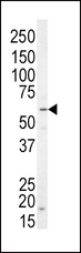 NRG1 / Heregulin / Neuregulin Antibody - Western blot of anti-NRG1 Antibody in SK-BR-3 cell line lysates (35 ug/lane). NRG1 (arrow) was detected using the purified antibody.