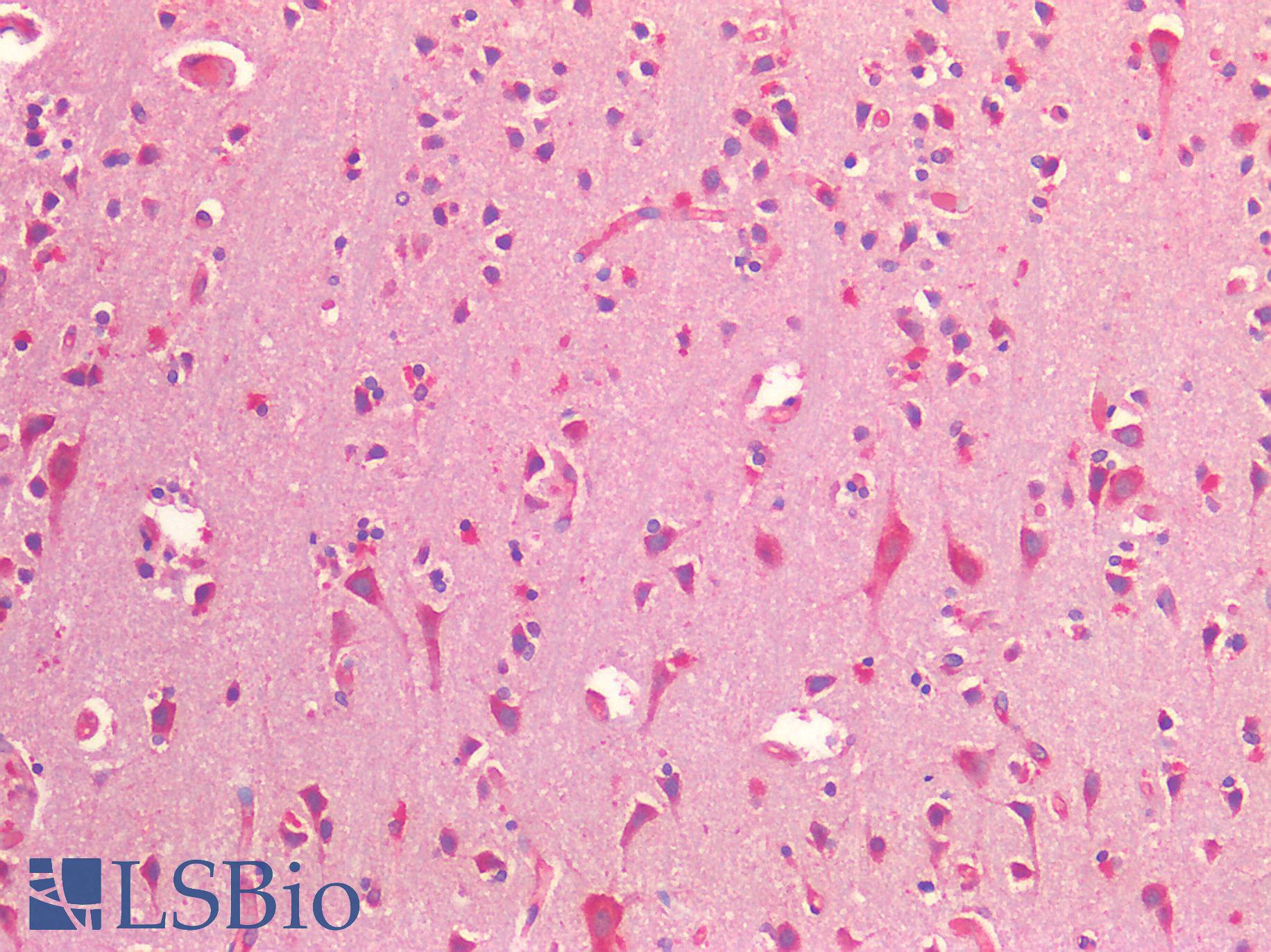 NRN1 / Neuritin Antibody - Human Brain, Cortex: Formalin-Fixed, Paraffin-Embedded (FFPE)