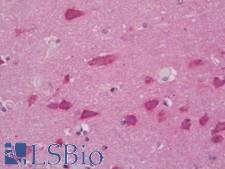 NRP1 / Neuropilin 1 Antibody - Human Brain, Cortex: Formalin-Fixed, Paraffin-Embedded (FFPE)