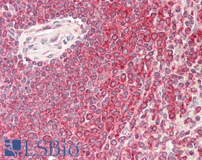 NSD3 / WHSC1L1 Antibody - Human Spleen: Formalin-Fixed, Paraffin-Embedded (FFPE)
