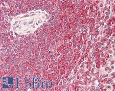 NSD3 / WHSC1L1 Antibody - Human Spleen: Formalin-Fixed, Paraffin-Embedded (FFPE)