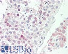 NSG1 Antibody - Anti-NSG1 antibody IHC staining of human testis. Immunohistochemistry of formalin-fixed, paraffin-embedded tissue after heat-induced antigen retrieval. Antibody dilution 1:200.