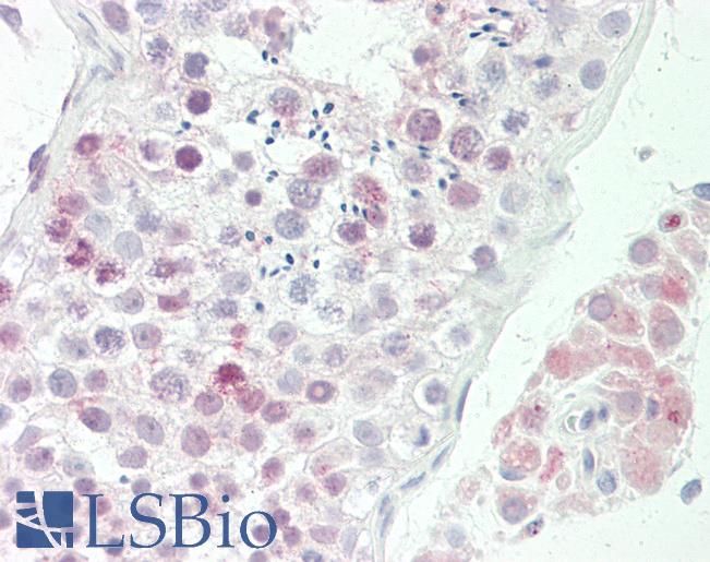 NSG1 Antibody - Anti-NSG1 antibody IHC staining of human testis. Immunohistochemistry of formalin-fixed, paraffin-embedded tissue after heat-induced antigen retrieval. Antibody dilution 1:200.