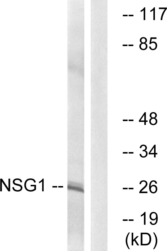 NSG1 Antibody - Western blot analysis of lysates from COLO cells, using NSG1 Antibody. The lane on the right is blocked with the synthesized peptide.