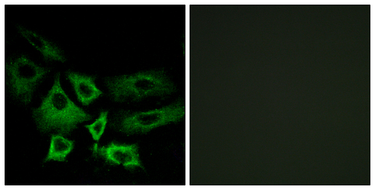 NT5C1A / CN1A Antibody - Immunofluorescence analysis of A549 cells, using NT5C1A Antibody. The picture on the right is blocked with the synthesized peptide.