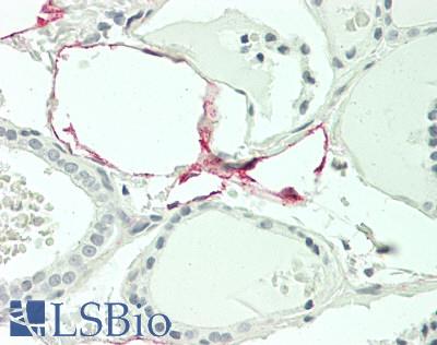 NT5E / eNT / CD73 Antibody - Human Thyroid, Capillaries: Formalin-Fixed, Paraffin-Embedded (FFPE) This image was taken for the unmodified form of this product. Other forms have not been tested.