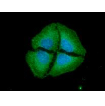 NT5E / eNT / CD73 Antibody - IF (ICC) notes: ICC/IF analysis of CD73 in HeLa cells. The cell was stained with CD73 antibody (1:100). The secondary antibody (green) was used Alexa Fluor 488. DAPI was stained the cell nucleus (blue).
