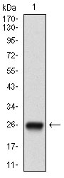 NT5E / eNT / CD73 Antibody - Western blot using NT5E monoclonal antibody against human NT5E (AA: ) recombinant protein. (Expected MW is 26.6 kDa)