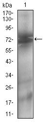 NT5E / eNT / CD73 Antibody - Western blot using NT5E mouse monoclonal antibody against A431 (1) cell lysate.