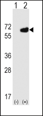 NT5E / eNT / CD73 Antibody - Western blot of NT5E (arrow) using rabbit polyclonal NT5E Antibody (M535). 293 cell lysates (2 ug/lane) either nontransfected (Lane 1) or transiently transfected (Lane 2) with the NT5E gene.
