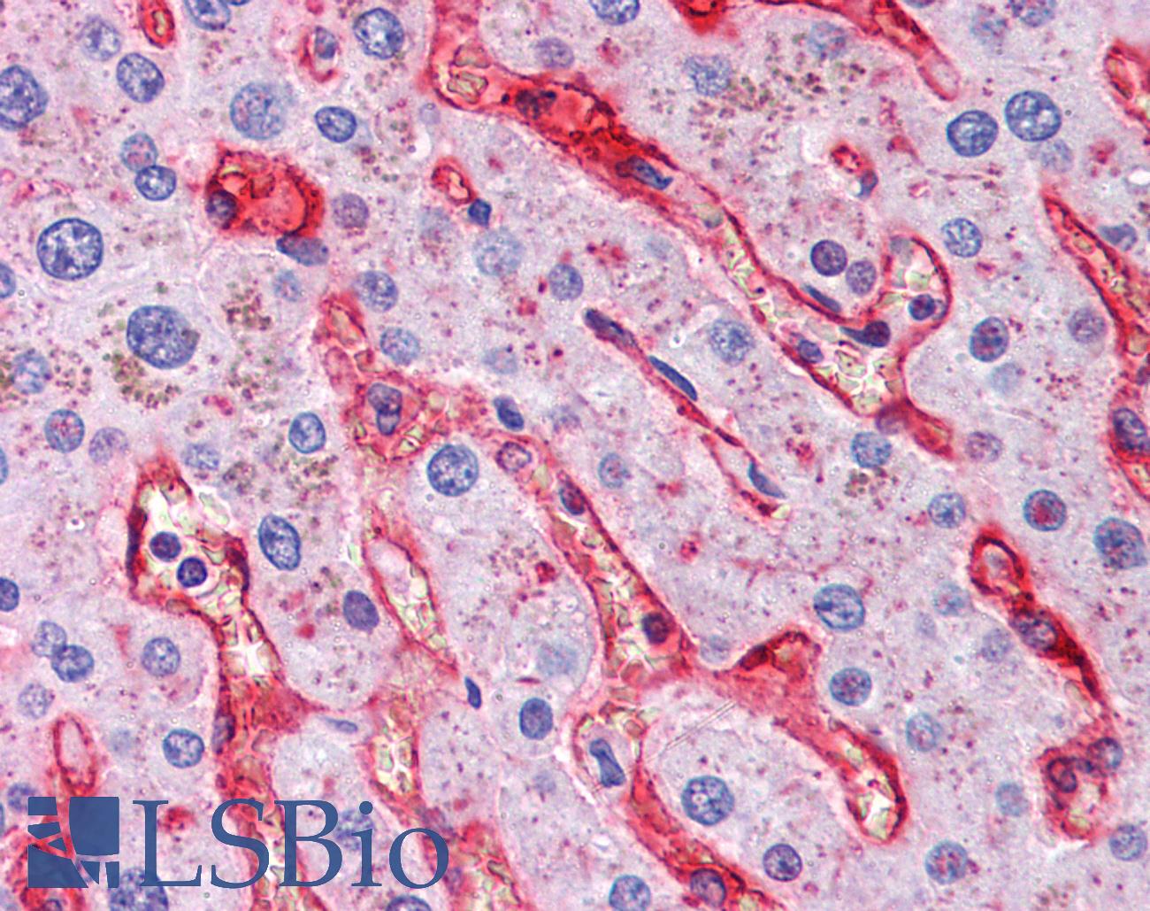 NT5E / eNT / CD73 Antibody - Anti-NT5E / CD73 antibody IHC of human liver. Immunohistochemistry of formalin-fixed, paraffin-embedded tissue after heat-induced antigen retrieval. Antibody dilution 1:200.