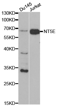 NT5E / eNT / CD73 Antibody - Western blot analysis of extracts of various cell lines, using NT5E antibody.