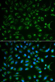 NT5E / eNT / CD73 Antibody - Immunofluorescence analysis of MCF7 cell using NT5E antibody. Blue: DAPI for nuclear staining.