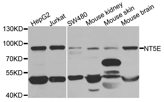 NT5E / eNT / CD73 Antibody - Western blot analysis of extracts of various cell lines.
