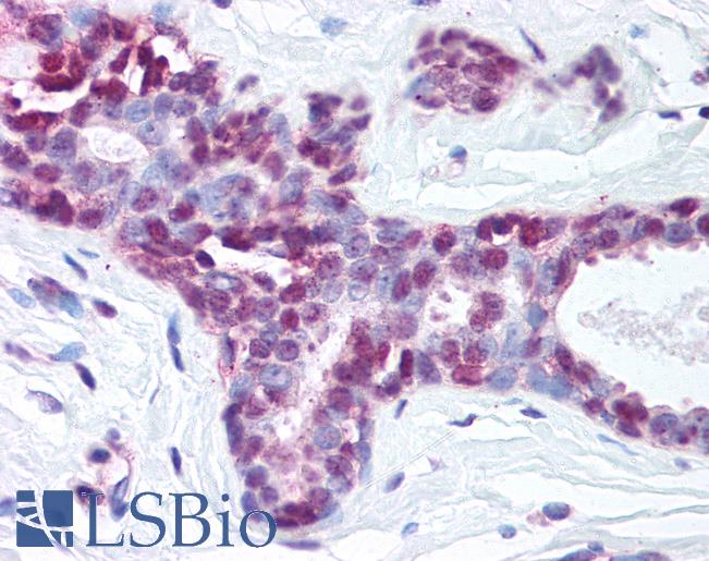 NTHL1 Antibody - Anti-NTH1 antibody IHC of human breast. Immunohistochemistry of formalin-fixed, paraffin-embedded tissue after heat-induced antigen retrieval. Antibody concentration 5 ug/ml.  This image was taken for the unconjugated form of this product. Other forms have not been tested.